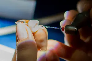 How is root canal done? An explanation of root canal procedure by dentist Dr. Richard Mitchell. 