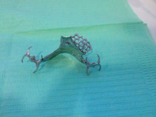 chrome cobalt upper denture chrome cobalt upper denture