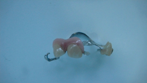 chrome cobalt upper denture chrome cobalt upper denture