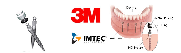 mini dental implant by 3M