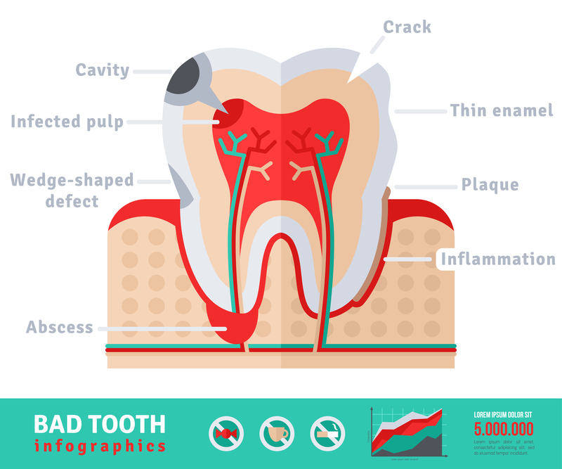 A diagram of tooth structure
