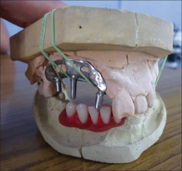 Custom made frame on a laboratory model