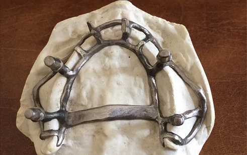 Custom made frame on a laboratory model