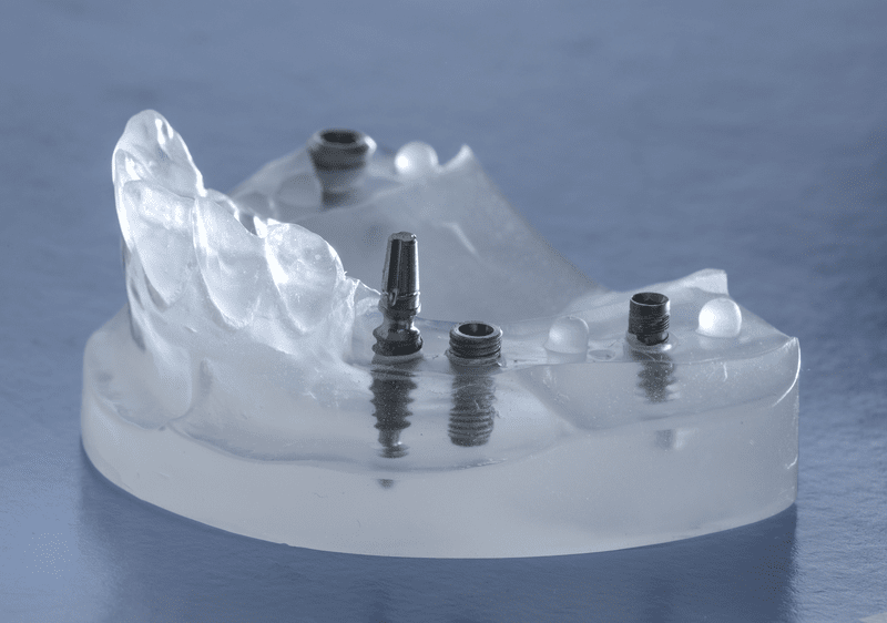 Dental implants in a transparent demonstration model Dental implants in a transparent demonstration model