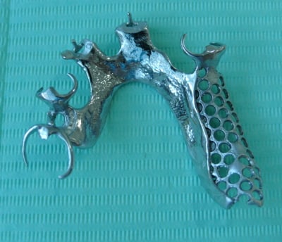 An upper chrome cobalt denture framework, minus teeth, on a green background