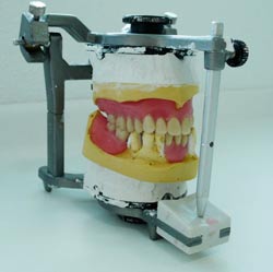 denture prices - the laboratory modelling