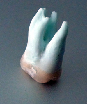 an extracted molar showing the complicated root structure an extracted molar showing the complicated root structure